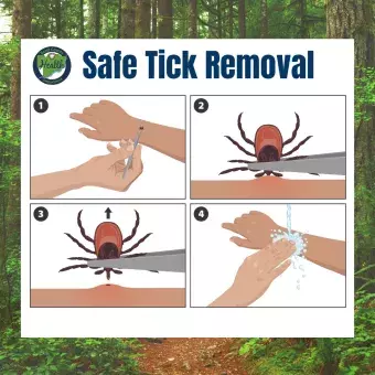 Safe tick removal infographic with title “Safe Tick Removal” and Scott County Health Department logo, showing four step-by-step illustrations: (1) hands using tweezers to grasp a tick on skin, (2) close-up of tweezers gripping tick near the skin surface, (3) upward removal of tick from skin, and (4) washing hands and bite area with soap and water, set against a forest background to emphasize outdoor safety and tick prevention.