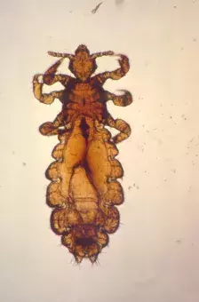 Head louse photo