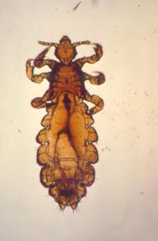 Head louse photo