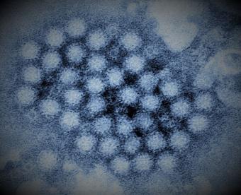 Electron microscope image of Norovirus
