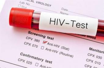 vile of blood with "HIV Test" label on it