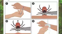 Safe tick removal infographic with title “Safe Tick Removal” and Scott County Health Department logo, showing four step-by-step illustrations: (1) hands using tweezers to grasp a tick on skin, (2) close-up of tweezers gripping tick near the skin surface, (3) upward removal of tick from skin, and (4) washing hands and bite area with soap and water, set against a forest background to emphasize outdoor safety and tick prevention.